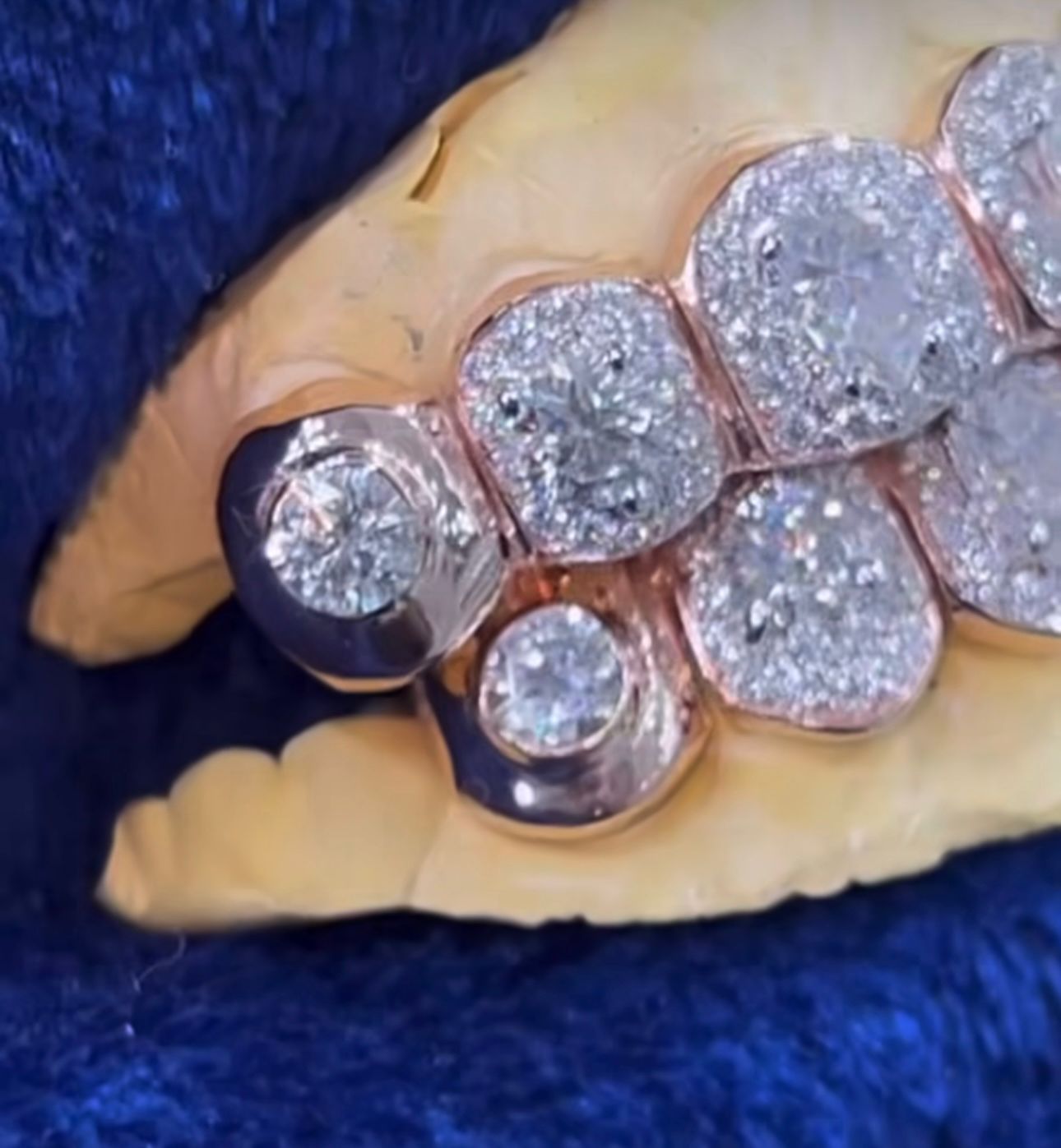 Moissanite Big Solitaire Custom Grillz 925 Silver