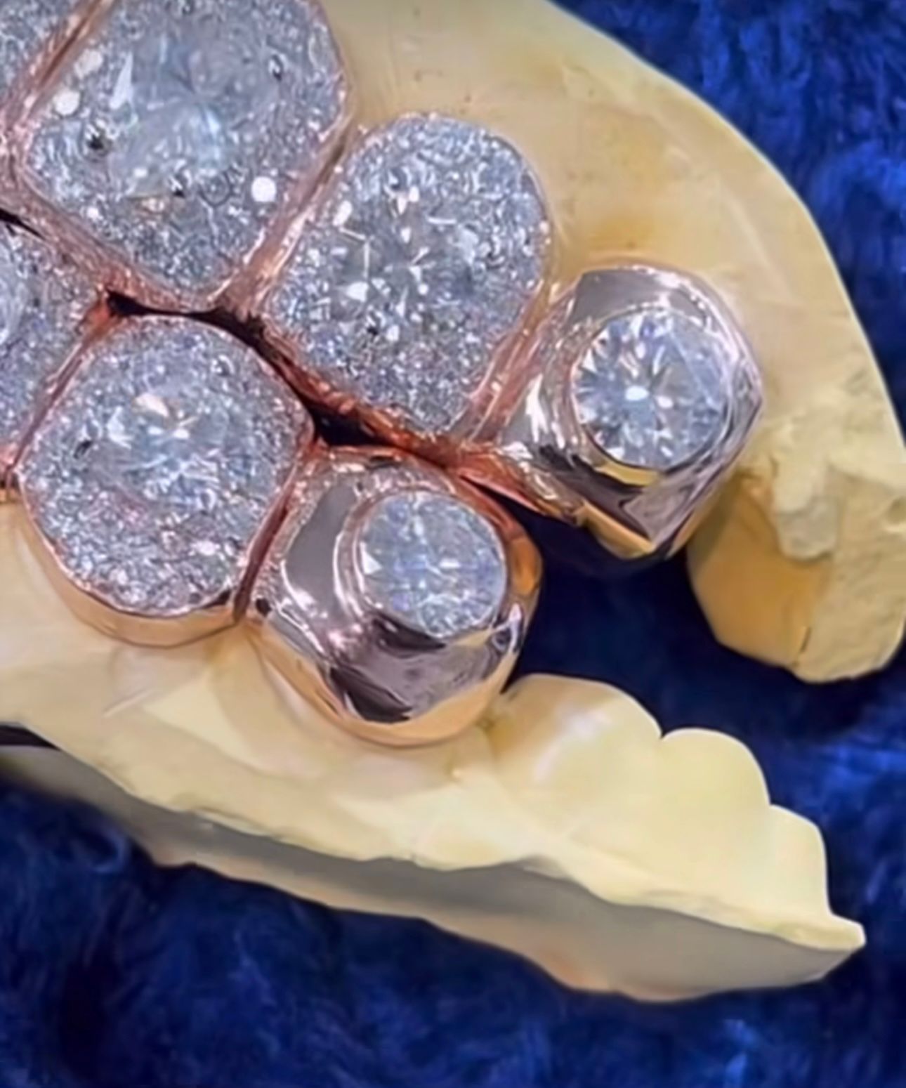 Moissanite Big Solitaire Custom Grillz 925 Silver