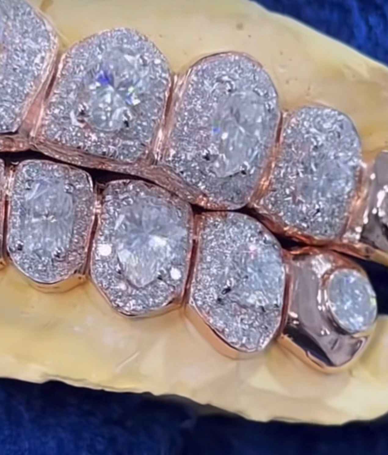 Moissanite Big Solitaire Custom Grillz 925 Silver