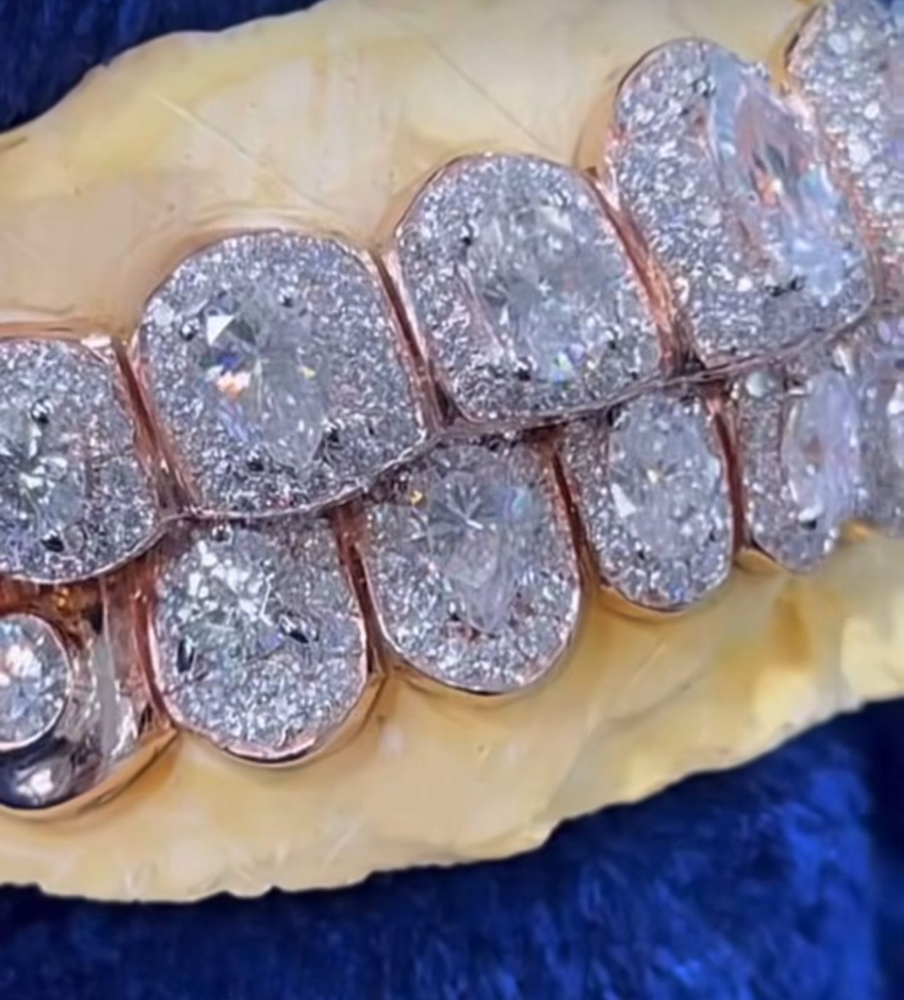 Moissanite Big Solitaire Custom Grillz 925 Silver