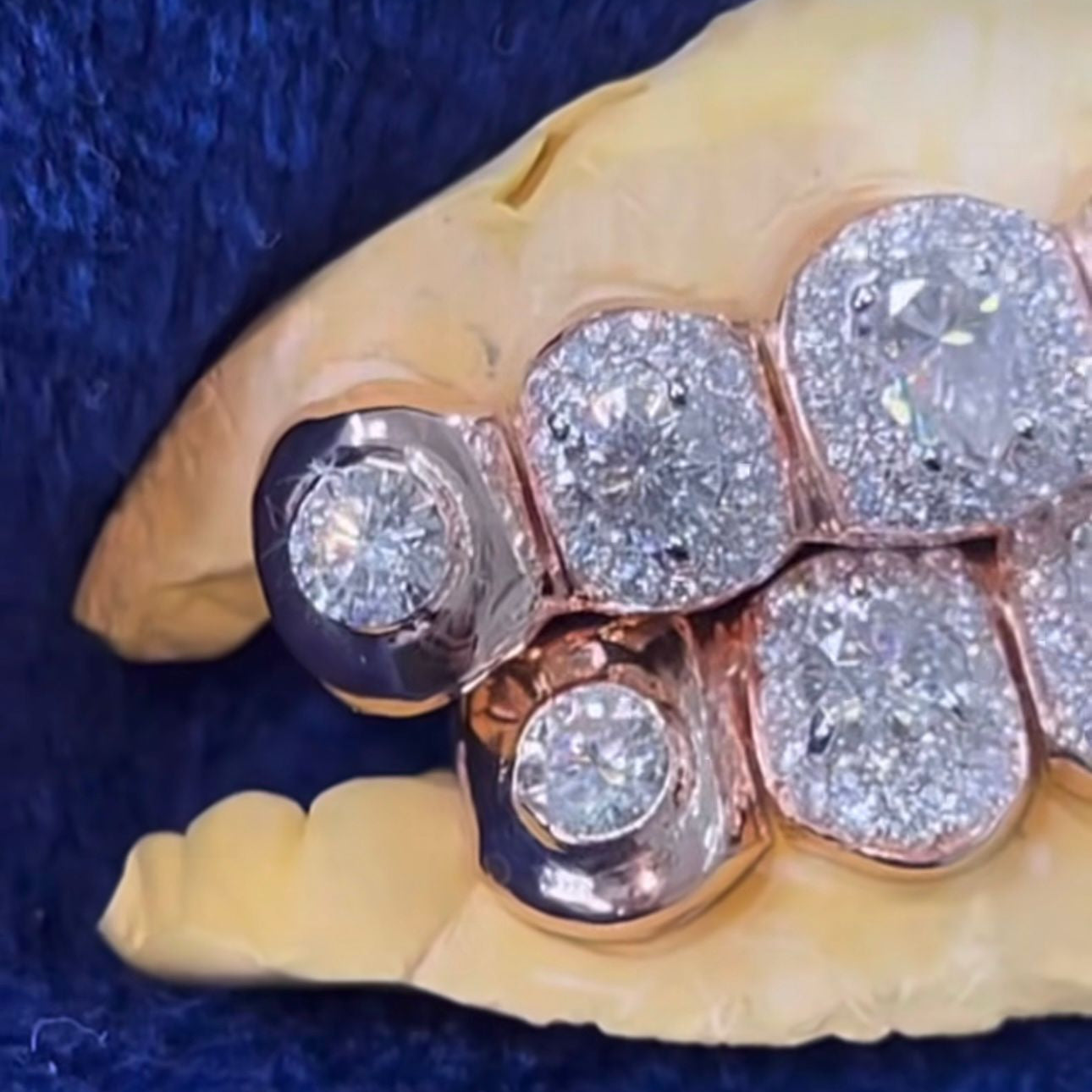 Moissanite Big Solitaire Custom Grillz 925 Silver