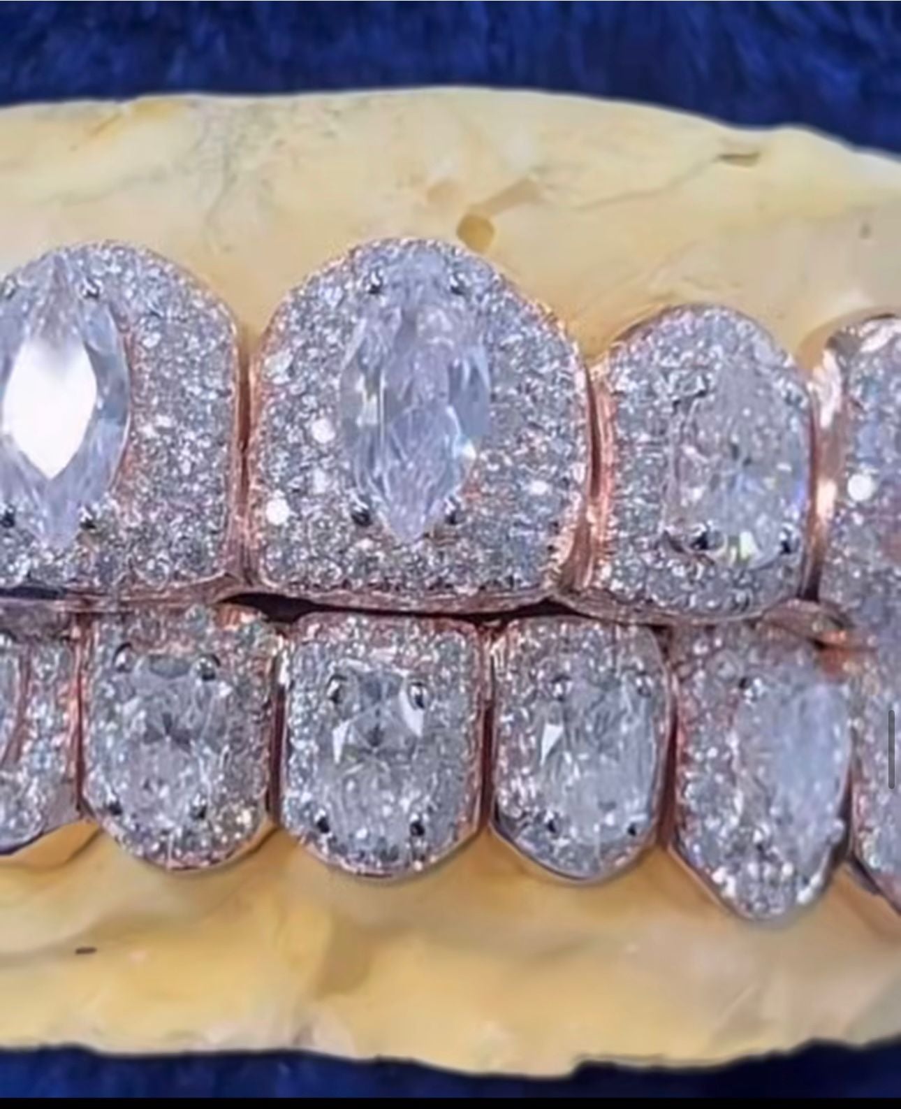 Moissanite Big Solitaire Custom Grillz 925 Silver