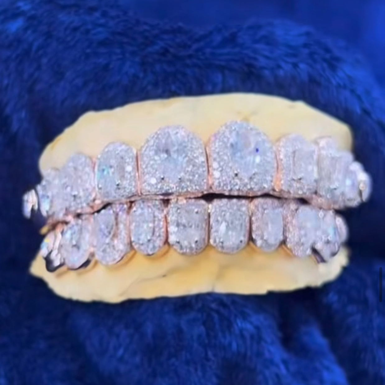 Moissanite Big Solitaire Custom Grillz 925 Silver