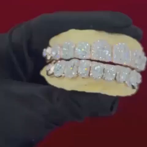 Moissanite Big Solitaire Custom Grillz 925 Silver